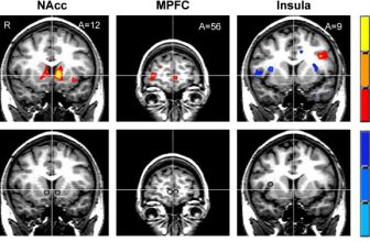 The Pain of Paying: Why Spending Money Literally Hurts