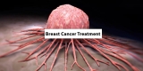 CBD and Breast Cancer: Evidence, Benefits, and Risks Explained