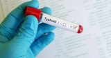 Medical Advisor Online: Typhoid Fever