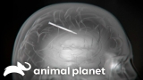 A Man Has A Whole Nail Stuck In His Brain! | Monsters Inside Me | Animal Planet