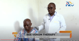 Video: Understanding apitherapy or bee venom therapy and how it works