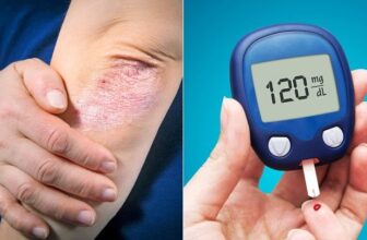 How To Reverse Type 2 Diabetes Naturally