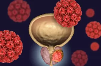 IMMUNOTHERAPY FOR PROSTATE CANCER WITH VDTP/GC-MAF – Healing Oracle