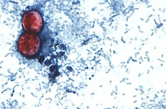 First two US deaths linked to diarrhea-inducing parasite confirmed — RT World News
