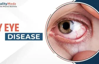 Symptoms, Causes & Best Treatment Options