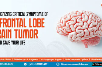 Recognizing Critical Symptoms of a Frontal Lobe Brain Tumor Could Save Your Life