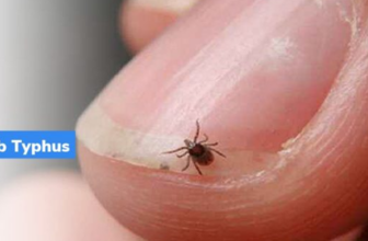 Scrub Typhus Symptoms, Causes, Diagnosis