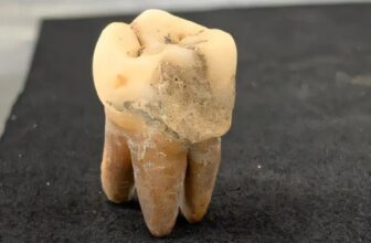 Ancient Dental Plaque and the Diets of Premodern Osaka’s Commoners