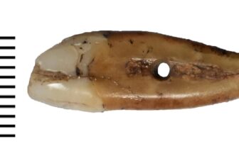 A Human Tooth, Drilled and Worn, From Late Neolithic Serbia