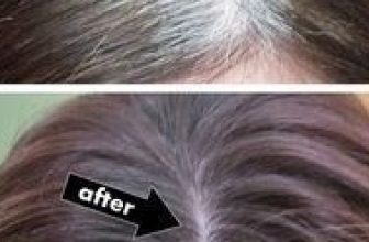 Home Remedy To Become Rid Of White Hair