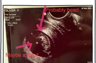 I Have Some News About A Brand-New Thing