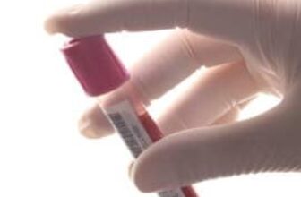 When “Normal” Lab Results Don’t Match How a Woman Feels – Women’s eNews