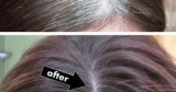 Home Remedy To Become Rid Of White Hair
