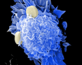 THE BEST INFORMATION YOU WILL EVER COME ACROSS ON PROSTATE CANCER.