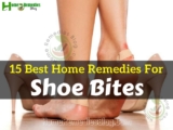 15 Best Home Remedies for Shoe Bites