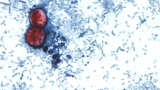 First two US deaths linked to diarrhea-inducing parasite confirmed — RT World News