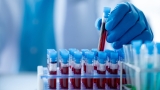 QC Healthcare and Sanguina collaborate for AI blood health tools