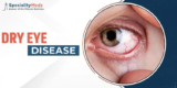 Symptoms, Causes & Best Treatment Options