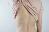 6 Bed Bug Infestation Signs in HDB