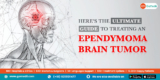 Here’s the Ultimate Guide to Treating An Ependymoma Brain Tumor