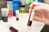 Is dengue pre-vaccination screening the way forward? · Break Dengue