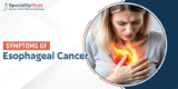 Symptoms of Esophageal Cancer