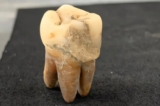 Ancient Dental Plaque and the Diets of Premodern Osaka’s Commoners