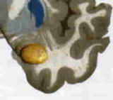 Wisdom Cafe Mental Well-being (Session 1 of 12) – Brain Leaders And Learners