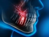 Best Medicine for Tooth Pain at Night (Fast Relief) – We Care All Pharmacy