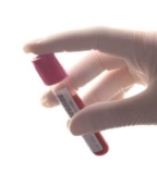 When “Normal” Lab Results Don’t Match How a Woman Feels – Women’s eNews