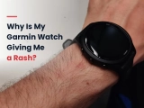 Why Is My Garmin Watch Giving Me a Rash?